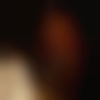 хітомі на we.ua